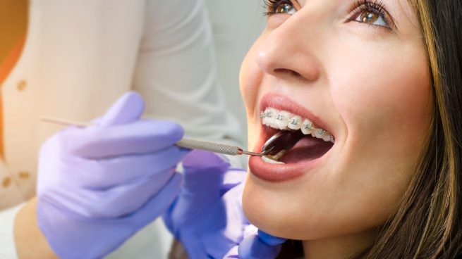 tratamientos dentales